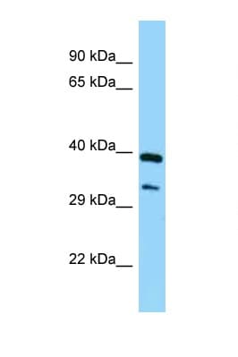 Polyclonal Rabbit anti-Human SPHK / SPHK1 Antibody (aa176-225, WB)