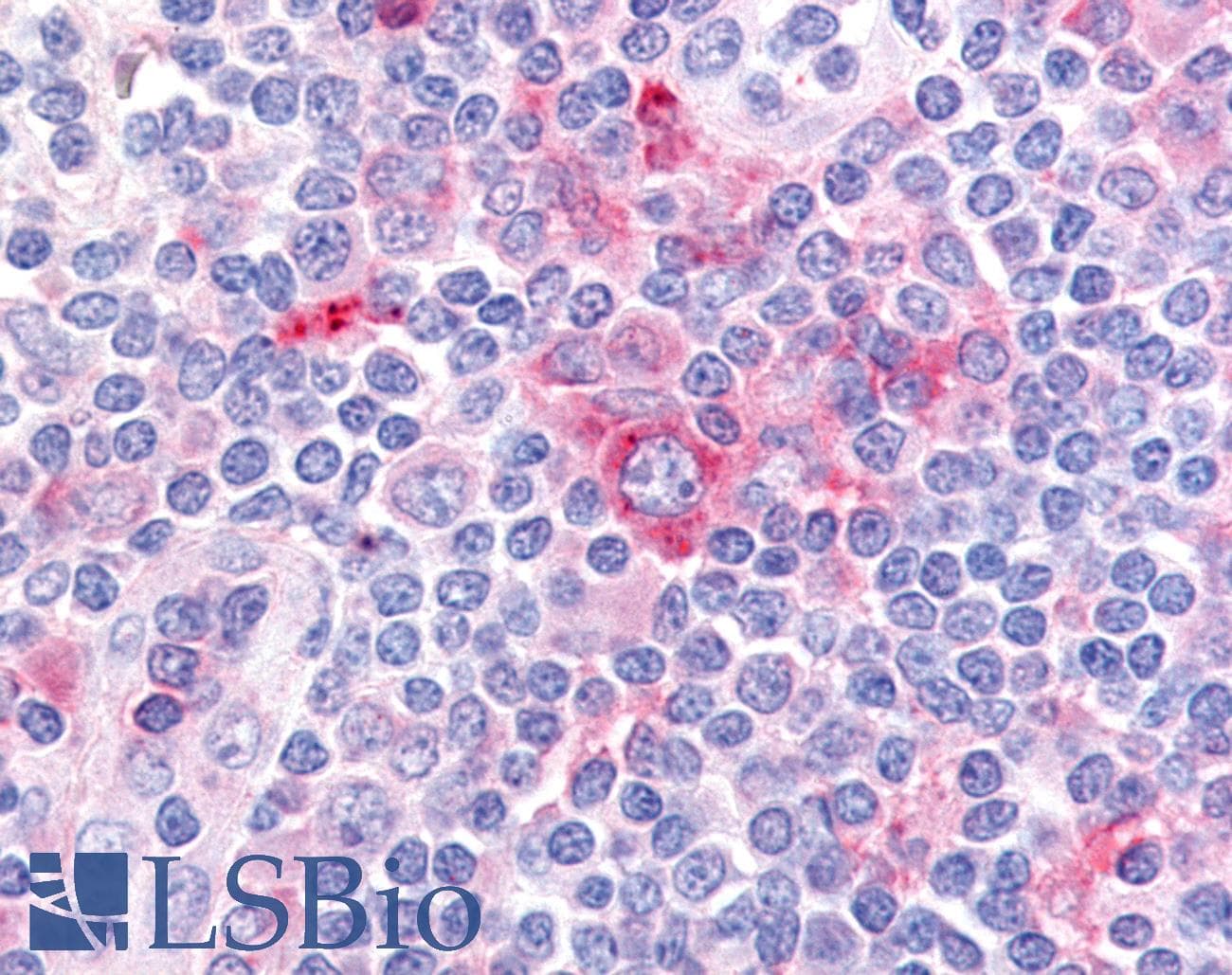 IHC-plus™ GPR62 Antibody (N-Terminus)