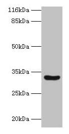 Polyclonal Rabbit anti-Human C2orf47 Antibody (IHC, WB)