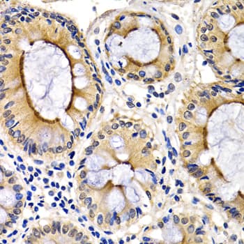 CDK7 Antibody