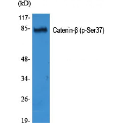 CTNNB1 / Beta Catenin Antibody (10-90 aa)