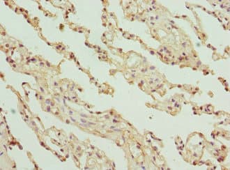 GLYCTK / Glycerate Kinase Antibody