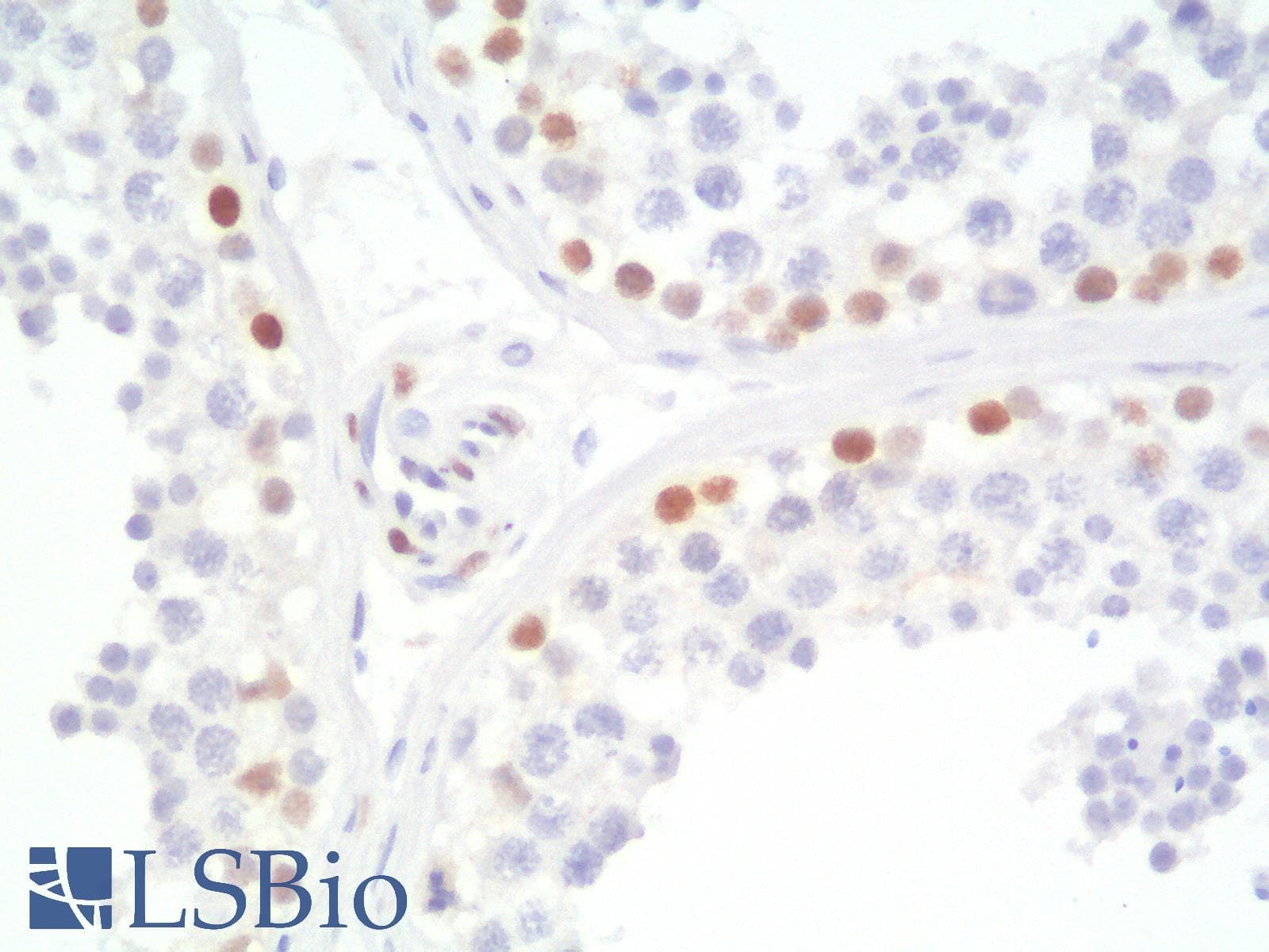 PathPlus™ TLE1 / TLE 1 Antibody (aa 175-338, clone TLE1/2946R)