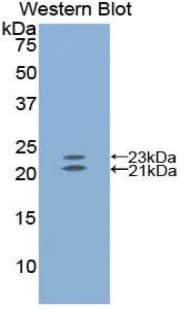 EDN1 / Endothelin 1 Antibody (aa33-202)