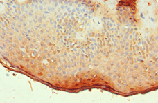 ALOX15B / 15-LOX-2 Antibody (aa1-200)