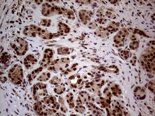 NSD3 / WHSC1L1 Antibody (aa427-566, clone OTI6A12, Carrier-free)