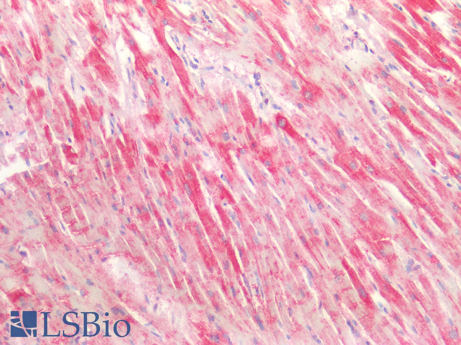 IHC-plus™ Polyclonal Rabbit anti-Human MAPRE2 / EB2 Antibody (IHC)