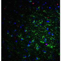 IHC-plus™ RTN4 / Nogo Antibody