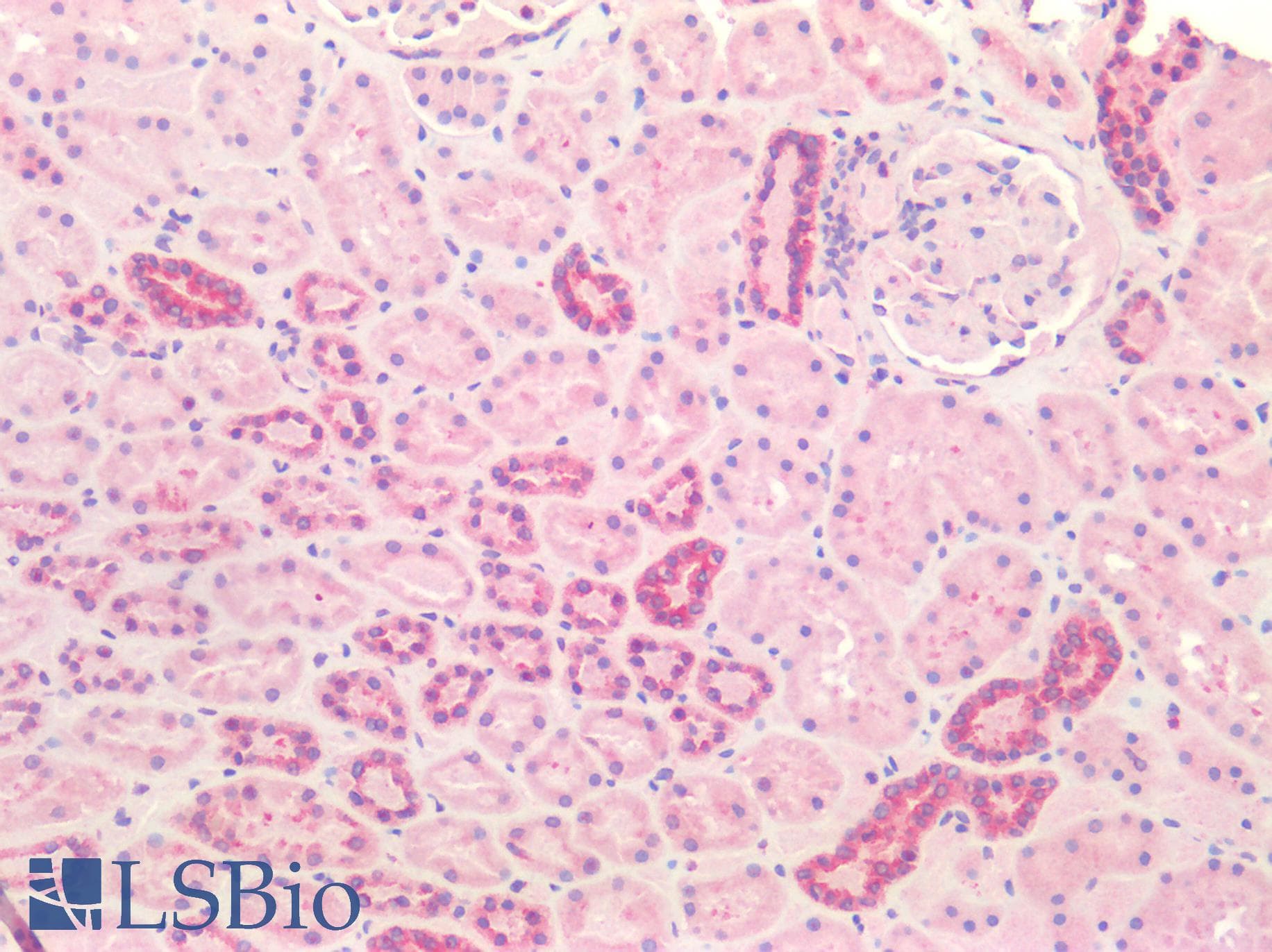 PathPlus™ Polyclonal Goat anti-Human CANX / Calnexin Antibody (aa200-250, IHC, IF, WB)