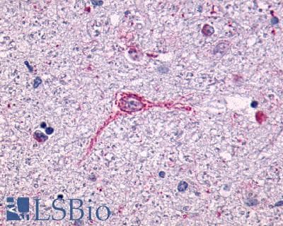 PathPlus™ Polyclonal Rabbit anti-Human NTSR1 / NTR Antibody (N-Terminus, IHC)