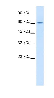 TRIM17 / RNF16 Antibody (aa254-303)