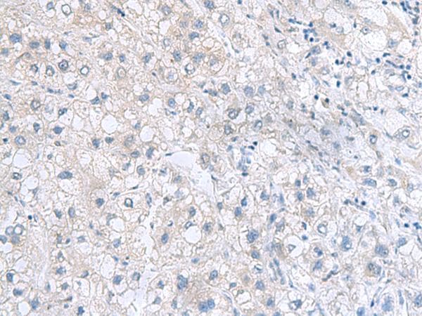 MYDGF / SF20 Antibody