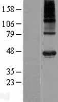 POC1A / SOFT Protein (Over-Expression Lysate Myc-DDK (Flag))