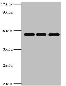 Polyclonal Rabbit anti-Human PIP4K2B Antibody (aa1-270, IHC, WB)