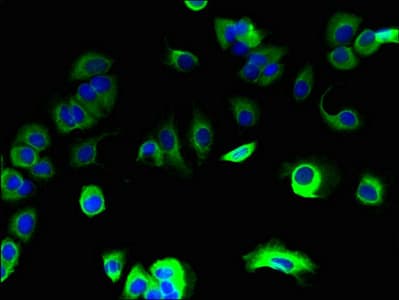 Polyclonal Rabbit anti-Human SPCS1 Antibody