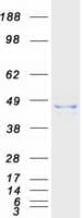Human ACAA2 Protein (Recombinant Myc-DDK (Flag))