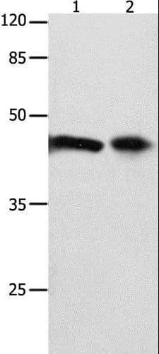 FOXL1 Antibody