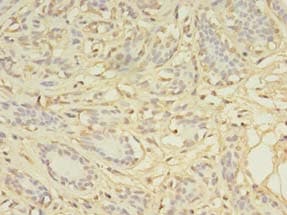 AGBL2 / CCP2 Antibody
