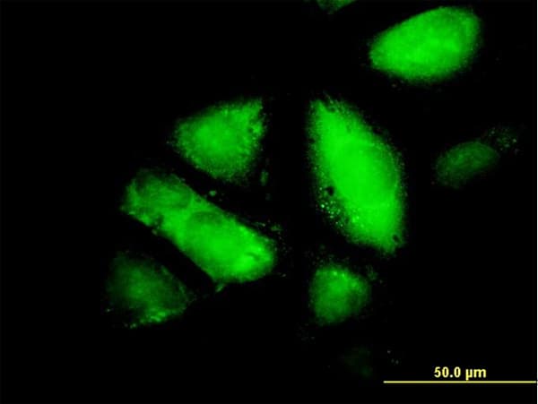 GSTZ1 Antibody (clone 1G12)