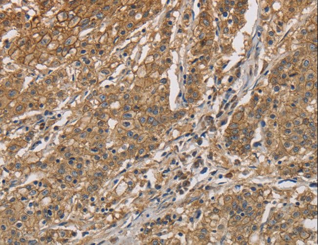 Polyclonal Rabbit anti-Human CKMT2 Antibody (IHC, WB)