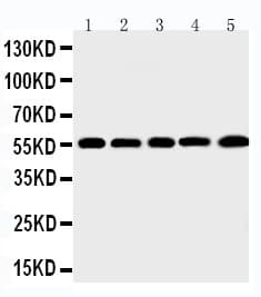 MMP12 Antibody (aa428-444)