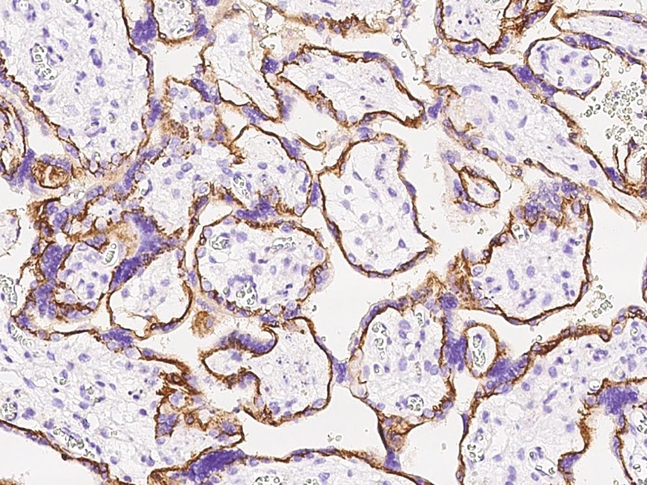CAPN6 / Calpain 6 Antibody (Preservative Free)