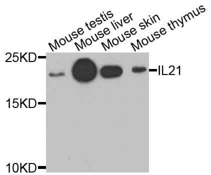 IL21 Antibody