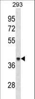 ACAA1 Antibody (aa147-176)