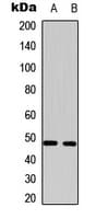 SLC16A14 / MCT14 Antibody (Internal)