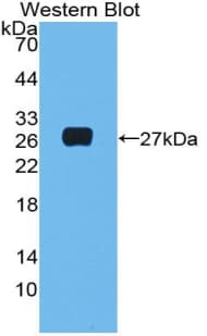 Complement C1QA Antibody (aa23-245)