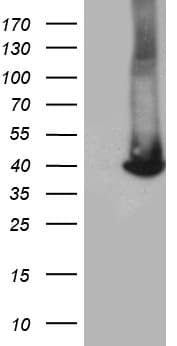 GALM / Mutarotase Antibody (clone OTI2F8)