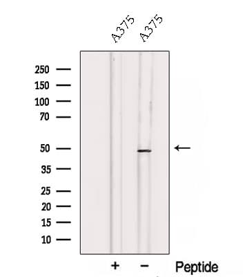 TCN2 Antibody