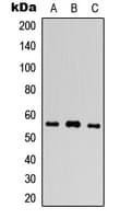 TEM7 Antibody (Internal)
