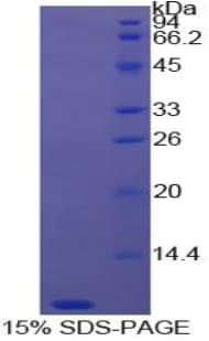 Bovine TMSB4X / Thymosin Beta-4 Protein (Recombinant His)