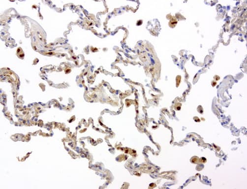 Monoclonal Mouse anti-Human TP / Thymidine Phosphorylase Antibody (clone UMAB90, aa311-482, IHC, WB)