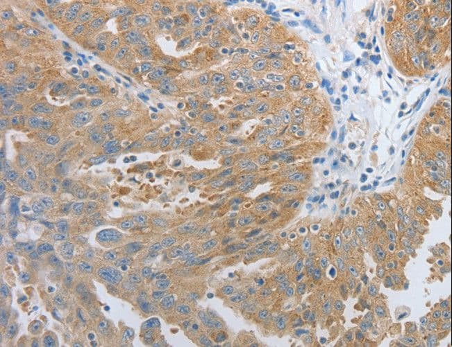 RHEB Antibody