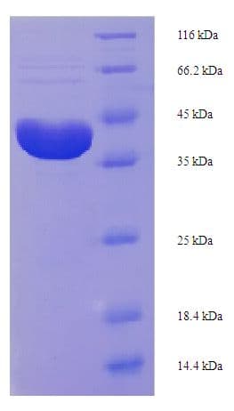 Trichosanthes kirilowii Alpha-Trichosanthin Protein (Recombinant His-SUMO)