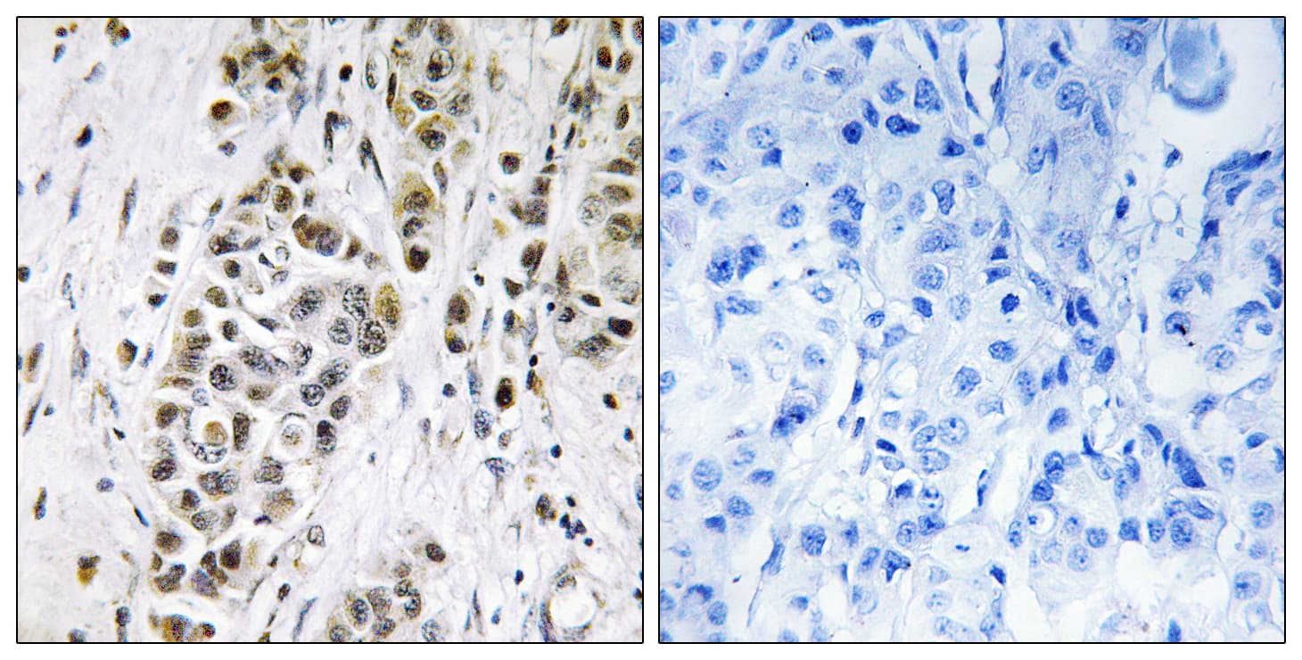 Polyclonal Rabbit anti-Human XRN2 Antibody (aa81-130, IHC, WB)