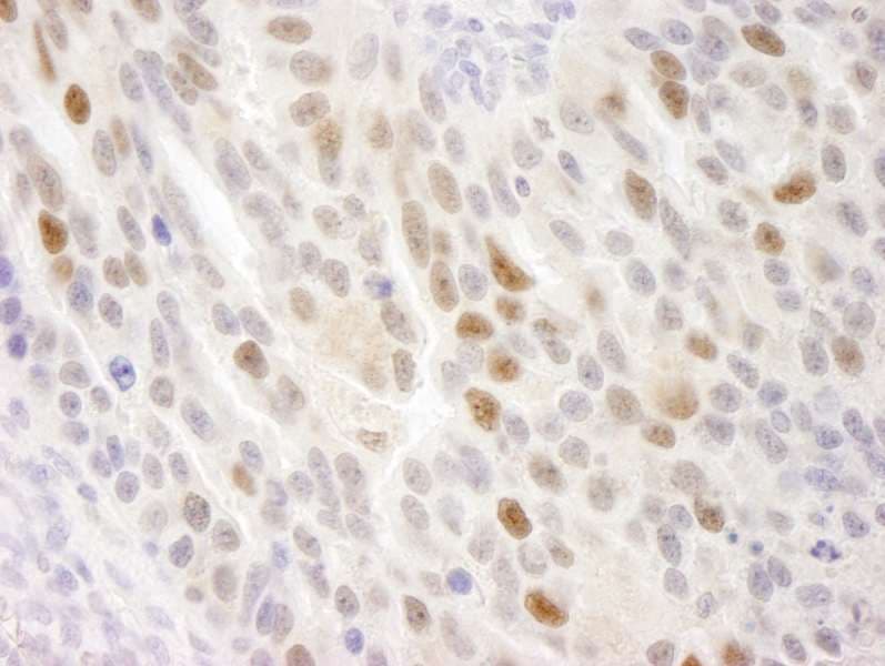 HSET / KIFC1 Antibody (aa625-673)