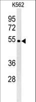 WDR73 Antibody (aa44-73)