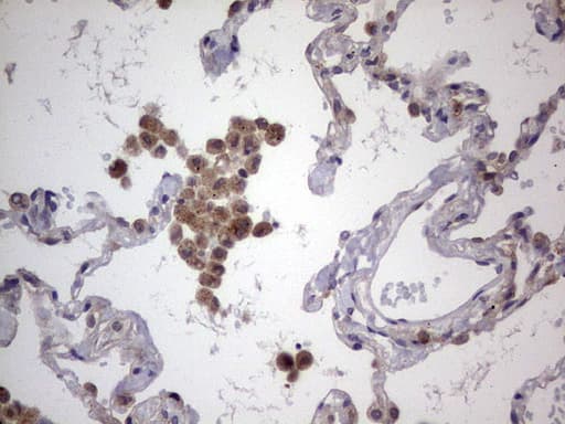LGALS3 / Galectin 3 Antibody (clone OTI6E1)
