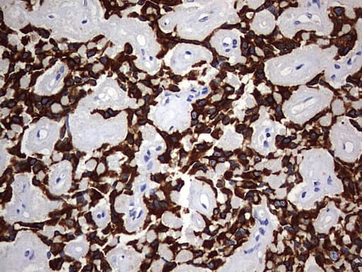Monoclonal Mouse anti-Human KRT24 / Keratin 24 Antibody (clone OTI4E8, aa139-397, IHC, WB)