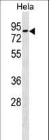 RHOT1 Antibody (aa84-110)