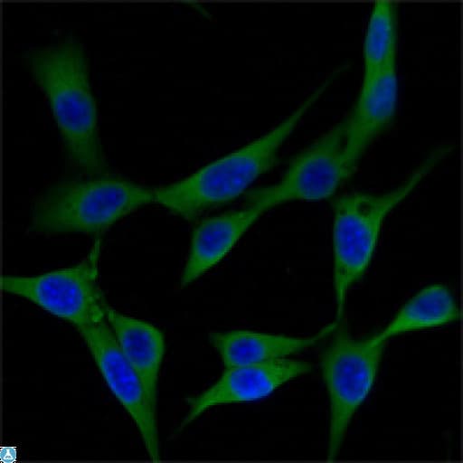 Monoclonal Mouse anti-Human HHIP / HIP Antibody (IHC, IF, WB)