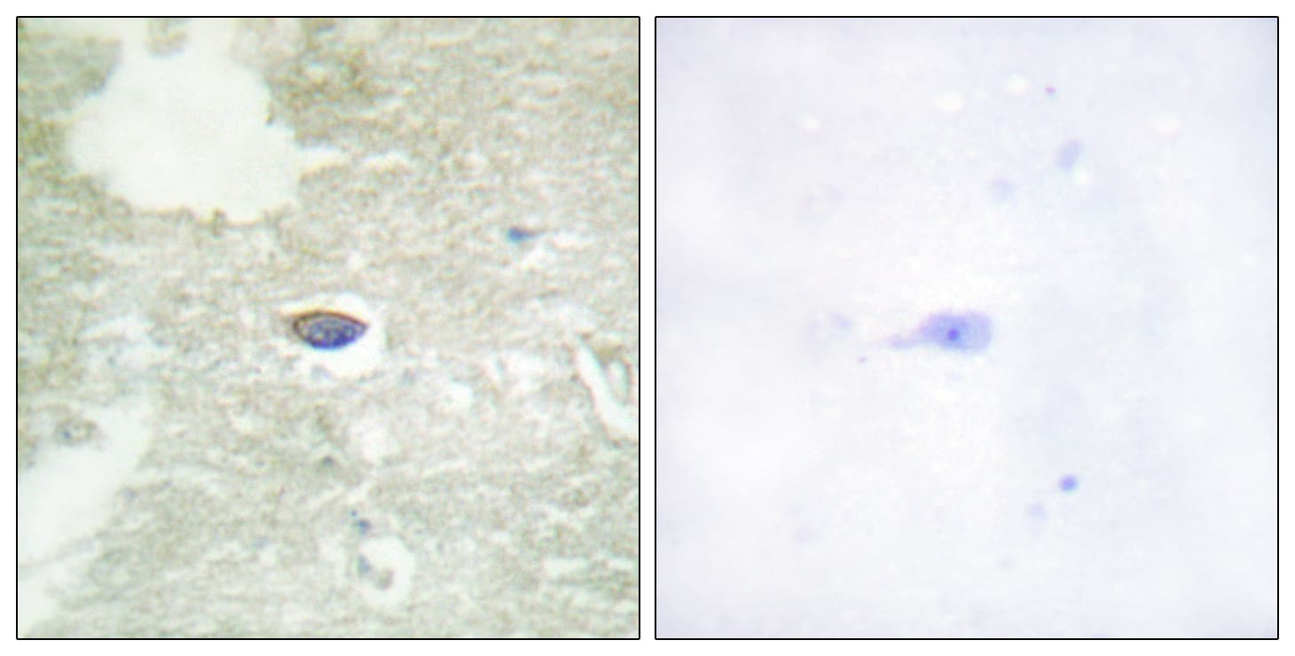 TGFBR2 Antibody (phospho-Ser225/Ser250)