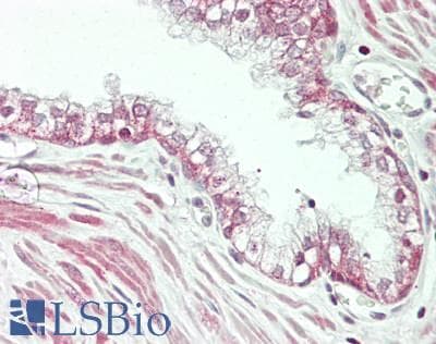 IHC-plus™ USP14 Antibody (aa450-C-term)