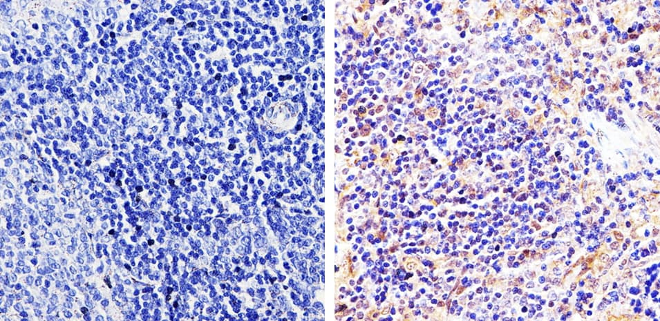 Polyclonal Rabbit anti-Human ARRB1 + ARRB2 Antibody (IHC, WB)