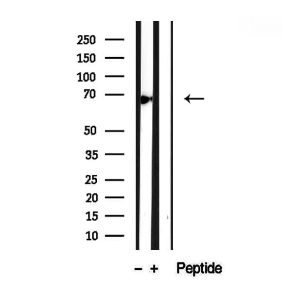 Polyclonal Rabbit anti-Human ATP6V1A1 / ATP6V1A Antibody (IHC, WB)
