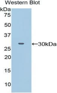 PCDHB2 / Protocadherin Beta 2 Antibody (aa54-291)