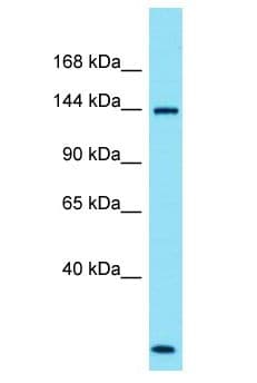 Polyclonal Rabbit anti-Human SPATA31A1 Antibody (aa20-69, WB)